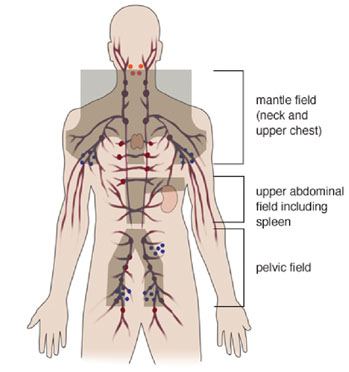 Radiation fields